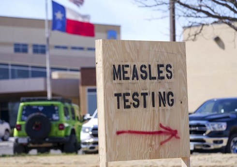 Число заразившихся корью в США превысило 700 человек