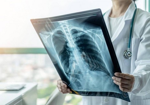 Директор НИИ легочных заболеваний назвала группы риска заражения туберкулезом