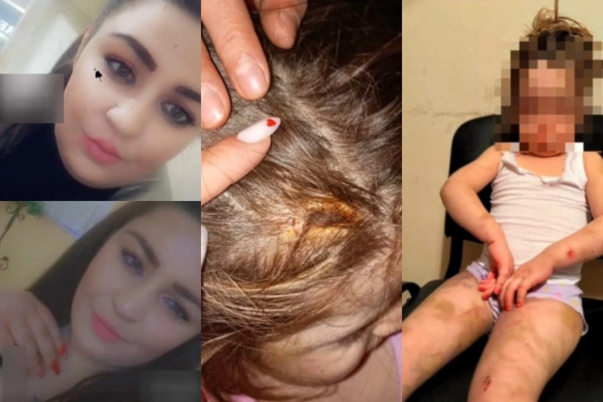 Новые детали жуткого инцидента с истязанием трехлетней девочки в Баку