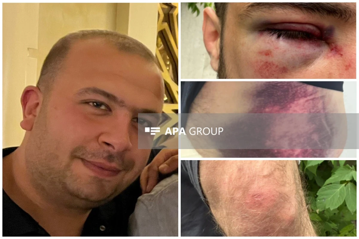 Подвергнутый пыткам в Екатеринбурге Вугар Сафаров: Нас хотели заставить съесть грязь, которая была внутри «Газели» -ФОТО