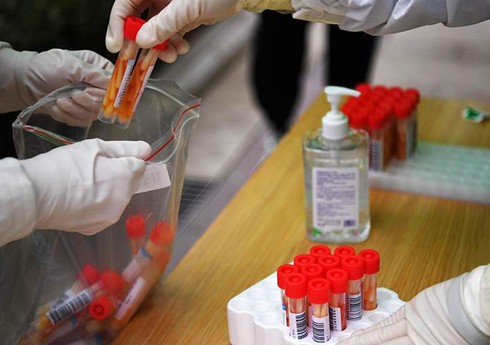 РФ направила запрос в КНР из-за сообщений о новом вирусе, поражающем мозг