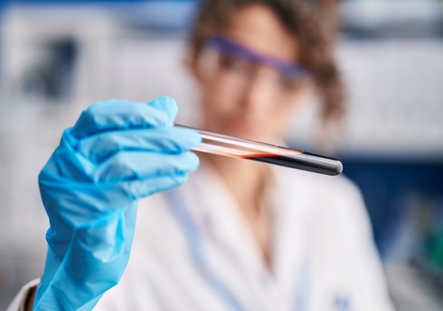 Ученые превратили кровь в материал для восстановления костей и других тканей организма