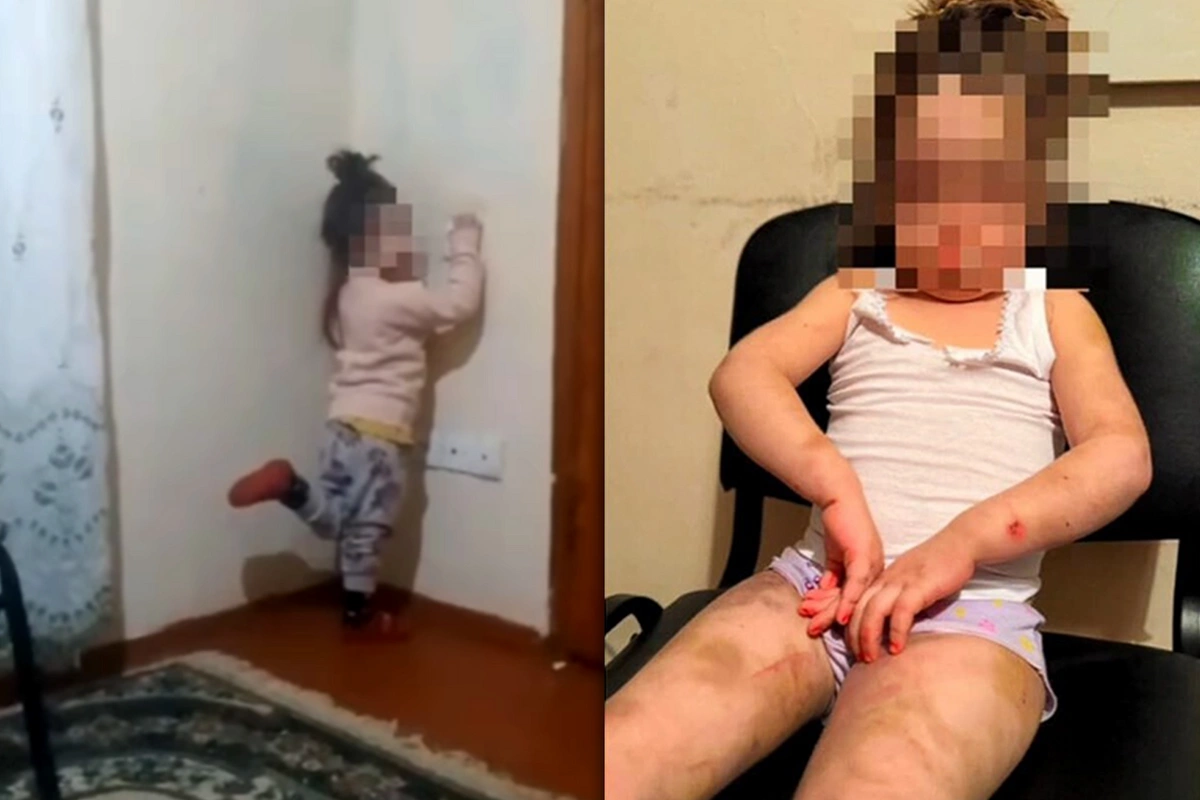 В Баку задержана мать, истязавшая своего ребенка