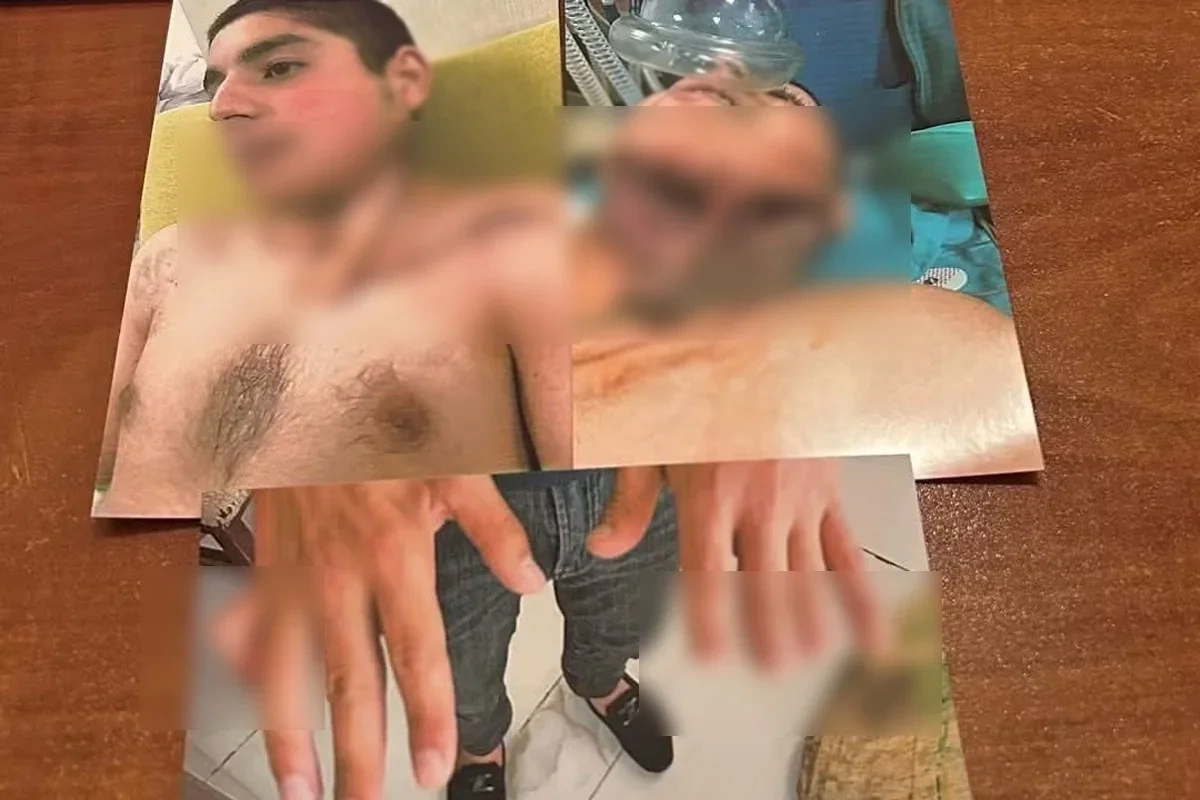 В TƏBİB объяснили, почему ветерану войны не продлили инвалидность