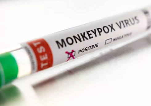 ВОЗ утвердила рекомендации по противодействию вспышке mpox в Африке